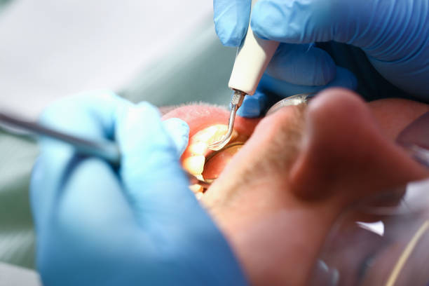 Best Emergency Treatment for Dental Infections or Abscesses in Blandon, PA