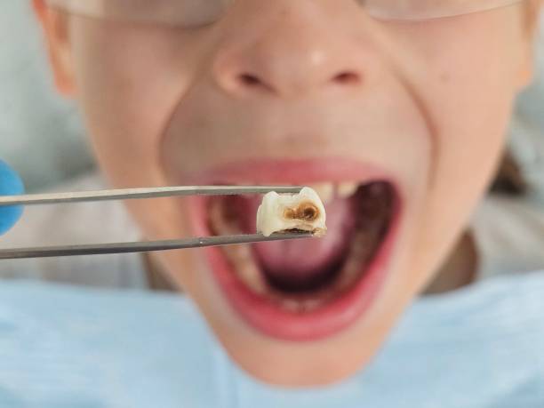 Best Pediatric Emergency Dentist in Blandon, PA