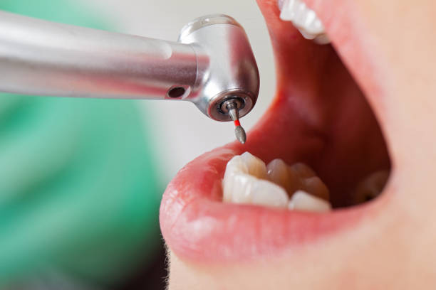 Best Emergency Dental Care for Broken or Chipped Teeth in Blandon, PA
